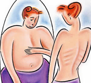 Anorexia nerviosa